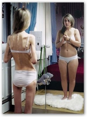 ANORESSIA E BULIMIA